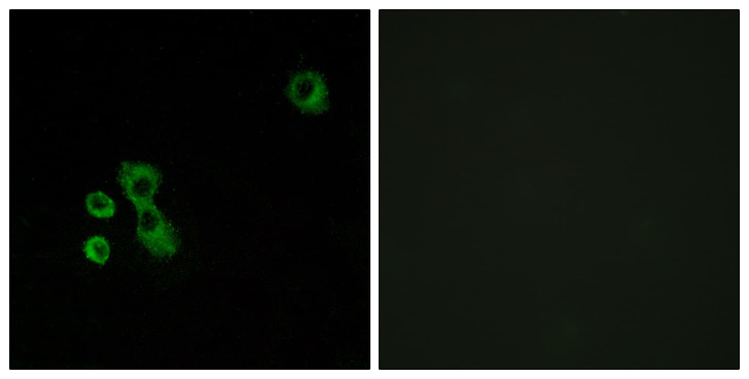 TAS2R7 / T2R7 Antibody (aa47-96)