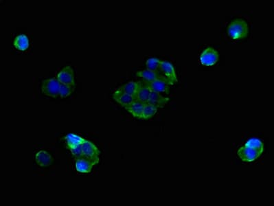 Polyclonal Rabbit anti-Human SLC25A38 Antibody