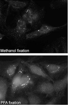 Polyclonal Rabbit anti-Human SQSTM1 Antibody (aa317-346, IHC, IF, WB)