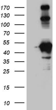 HOMER1 / Homer 1 Antibody (aa1-354, clone OTI3G5)