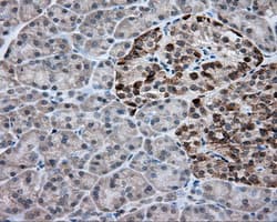 ACSBG1 / hsBG Antibody (clone OTI2B5)
