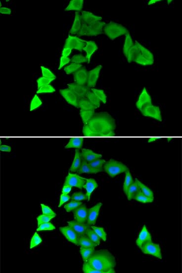 IHC-plus™ Calgizzarin / S100A11 Antibody