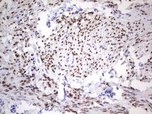 Monoclonal Mouse anti-Human PR / Progesterone Receptor Antibody (clone OTI4C12, aa1-298, IHC, WB)