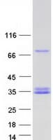 Human CFHR2 Protein (Recombinant Myc-DDK (Flag))