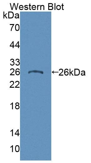 CSPG4 / NG2 Antibody (aa559-776, Biotin)