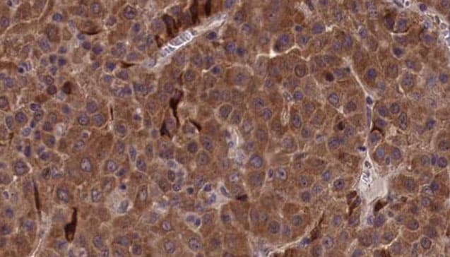 Polyclonal Rabbit anti-Human ITGB2 / CD18 Antibody (IHC, WB)