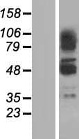 ZBTB43 Protein (Over-Expression Lysate Myc-DDK (Flag))