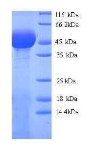 Chamaecyparis obtusa PLY1 / Pectate lyase 1 Protein (Recombinant His)
