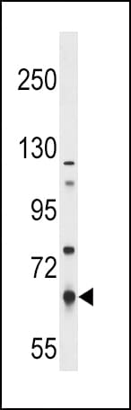 Polyclonal Rabbit anti-Human PKLR Antibody (aa1-30, IHC, WB)