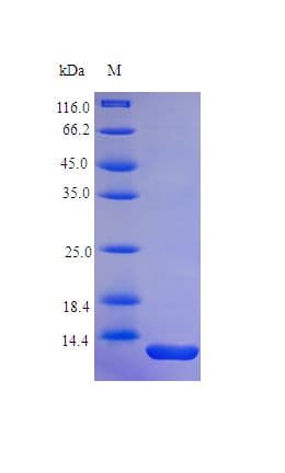 Human PTH / Parathyroid Hormone Protein (Recombinant)