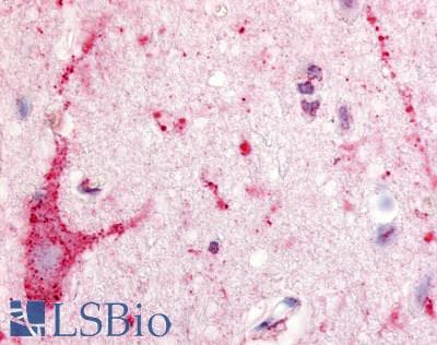 IHC-plus™ Polyclonal Rabbit anti-Human S1PR5 / EDG8 / S1P5 Antibody (Cytoplasmic Domain, IHC)