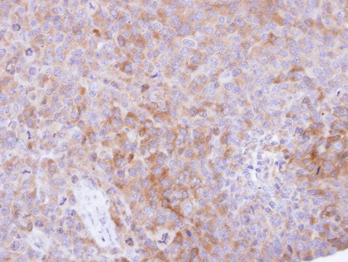 Polyclonal Rabbit anti-Human TBCB / CKAP1 Antibody (aa1-243, IHC, WB)