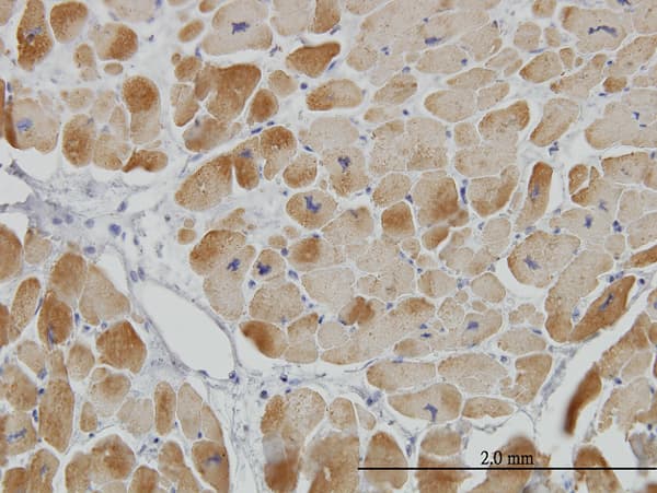 Monoclonal Mouse anti-Human ACADVL Antibody (clone 5D3, IHC, WB)