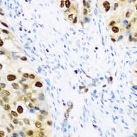 KHDRBS2 / SLM-1 Antibody
