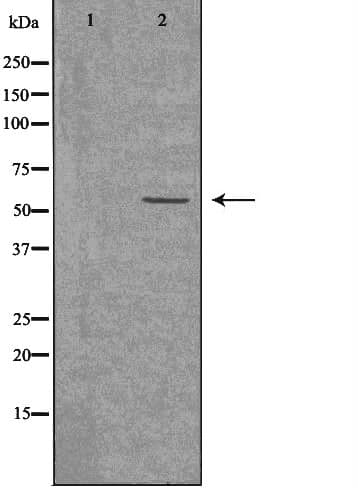 ACVRL1 Antibody