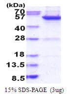 Human MINA / MINA53 Protein (Recombinant His)