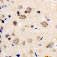 ADRB1 Antibody (Internal)
