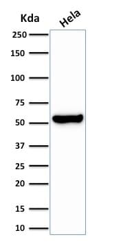 HSPD1 / HSP60 Antibody (clone HSPD1/2206R)