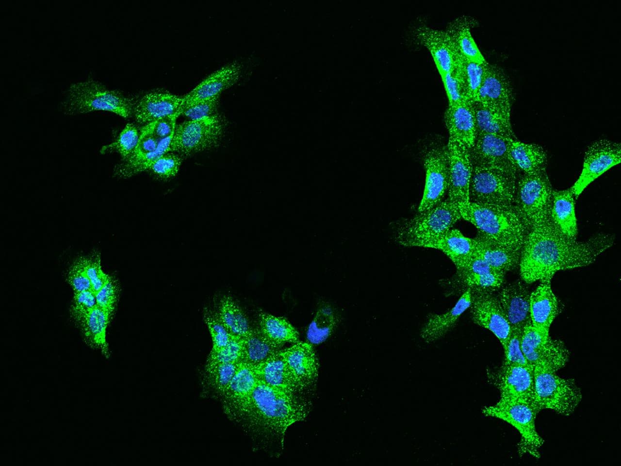 Polyclonal Rabbit anti-Human ACOX1 / ACOX Antibody (IHC, IF)