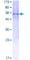 Human HnRNP A0 Protein (Recombinant GST)
