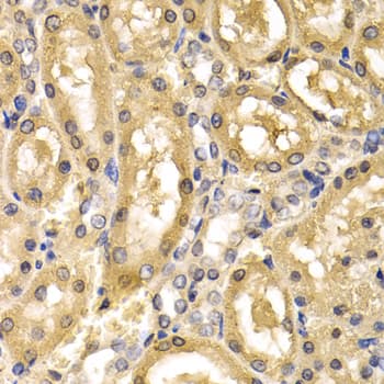 ADH4 Antibody