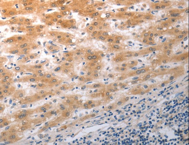 NQO2 Antibody