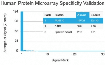 Monoclonal Mouse anti-Human PMEL / SILV / gp100 Antibody (clone PMEL/2038, IHC)