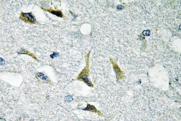 FAK / Focal Adhesion Kinase Antibody (phospho-Tyr925)