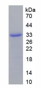 Mouse ITGB2 / CD18 Protein (Recombinant His-T7)