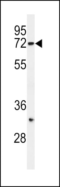 SYVN1 / HRD1 Antibody (aa106-138)
