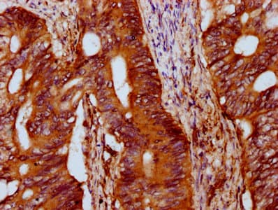 IFT172 Antibody