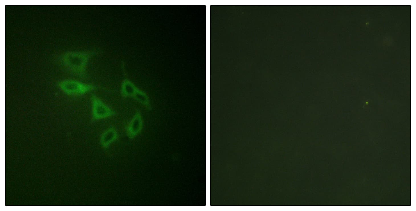 PIKFYVE / PIP5K Antibody (phospho-Ser307)