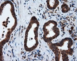 TPMT Antibody (clone OTI2A2)