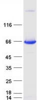 Human SCP2 / SCPX Protein (Recombinant Myc-DDK (Flag))