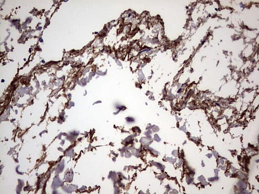 IL1RN Antibody (clone OTI2B1)