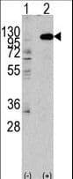FGFR2 / FGF Receptor 2 Antibody (aa794-821)