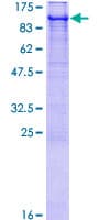 Human E6AP / UBE3A Protein (Recombinant GST)
