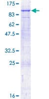 Human CAPN10 / Calpain 10 Protein (Recombinant GST)
