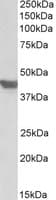IHC-plus™ Polyclonal Goat anti-Human SLC2A4 / GLUT-4 Antibody (aa498-509, IHC, WB)