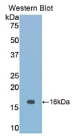 NOS1 / nNOS Antibody (aa1213-1337)