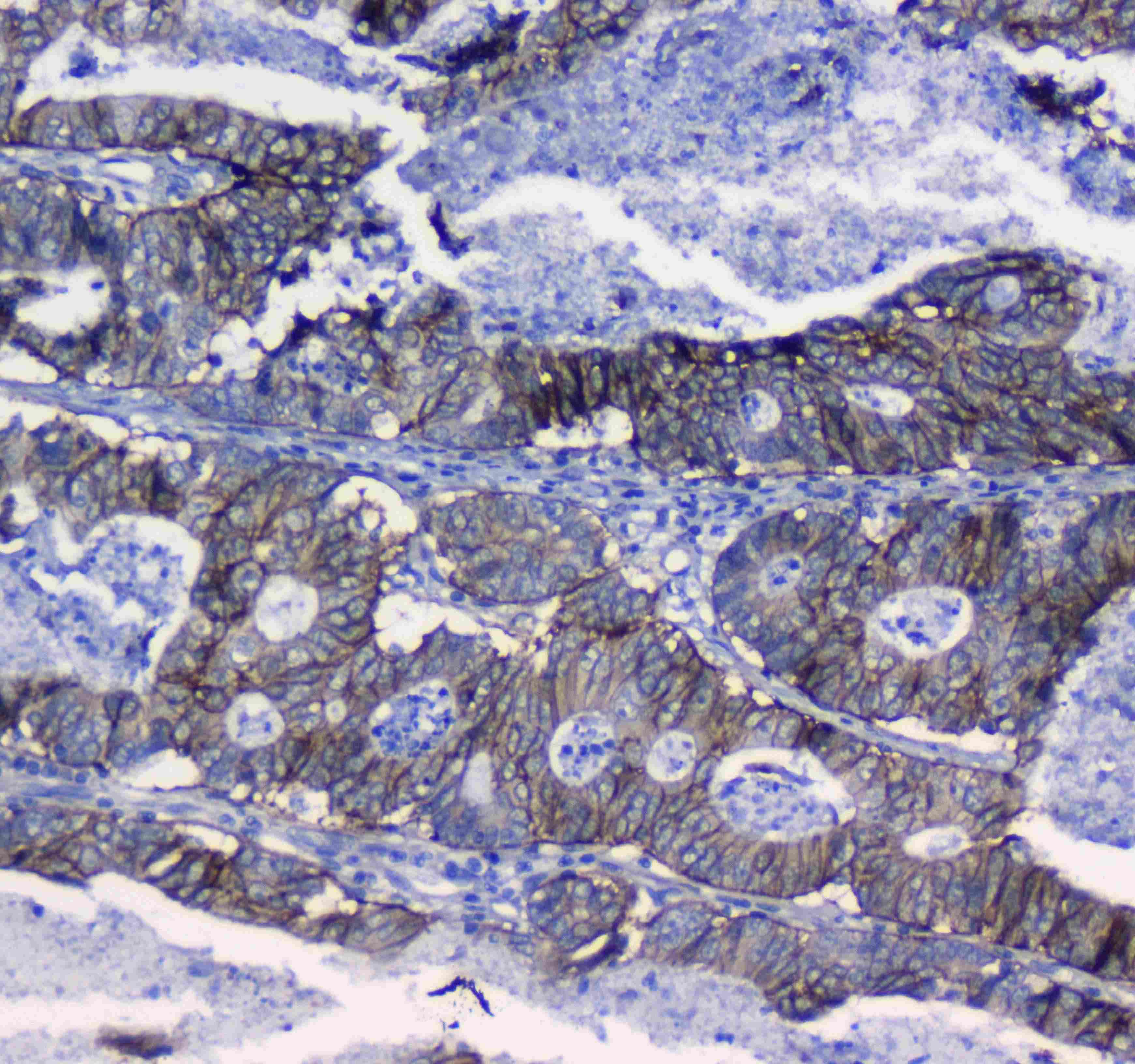 Polyclonal Rabbit anti-Human ITGA5/Integrin Alpha 5/CD49e Antibody (IHC, WB)