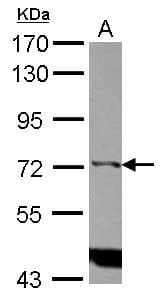 Polyclonal Rabbit anti-Human ITPKC Antibody (Internal, WB)