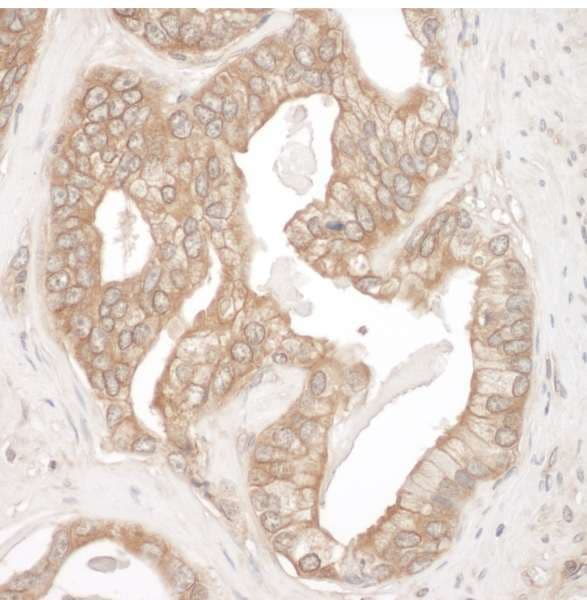 IHC-plus™ CTTN / Cortactin Antibody (aa450-500)
