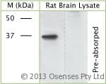 GAP43 Antibody (phospho-Ser41)