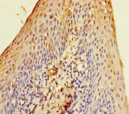 SLURP1 / ARS / MDM Antibody
