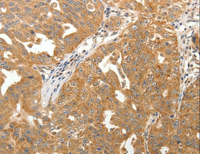 MAP1B Antibody