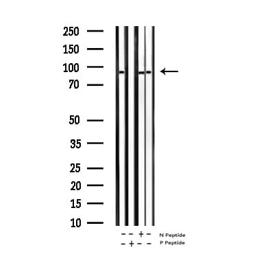 Polyclonal Rabbit anti-Human MAPT / Tau Antibody (phospho-Ser235, IHC, WB)