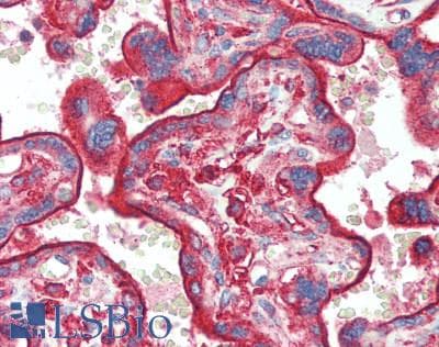 IHC-plus™ Polyclonal Rabbit anti-Human CLTC / Clathrin Heavy Chain Antibody (IHC, WB)