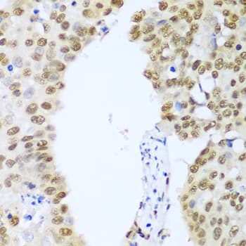 HDAC1 Antibody