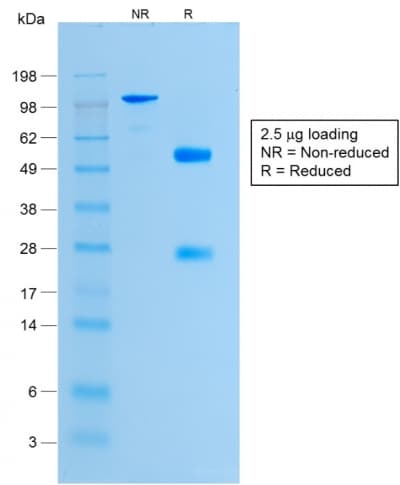 Histone H1 Antibody (clone HH1/1784R)